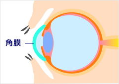 図